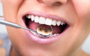 Orthodontie et orthodontistes